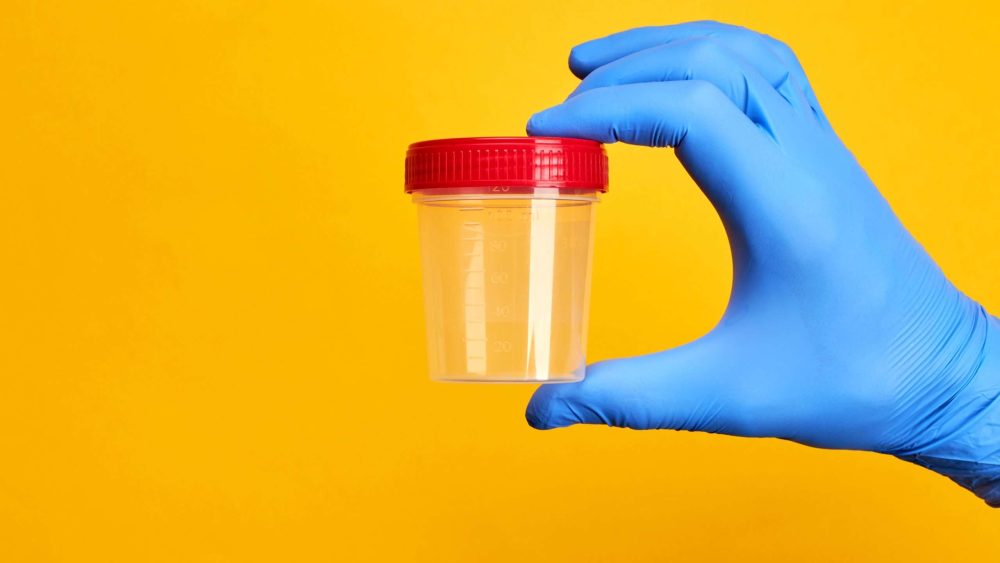 The Role of Drug and Alcohol Testing in Pre-Employment Screening